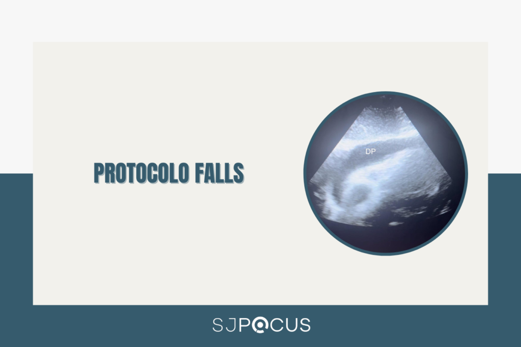 PROTOCOLO FALLS SJPOCUS